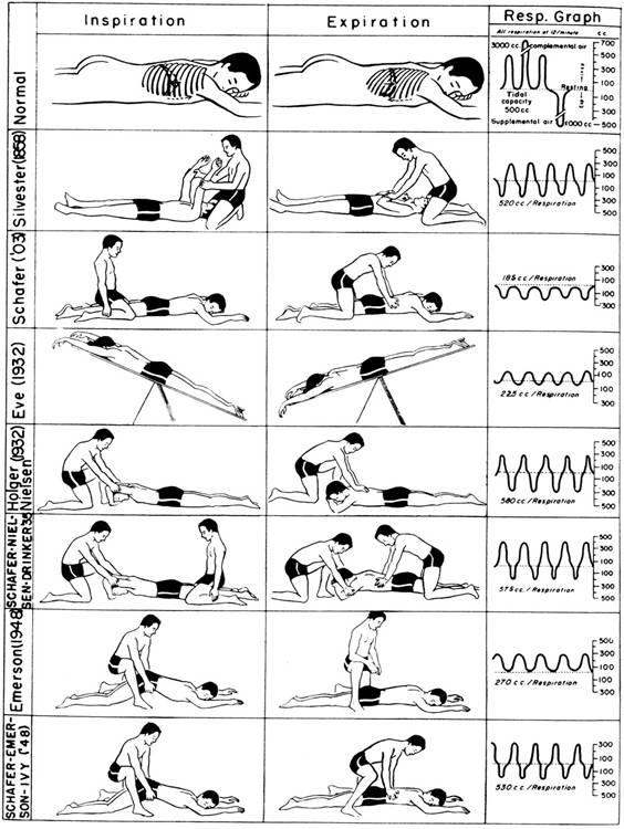 artificial respiration procedure